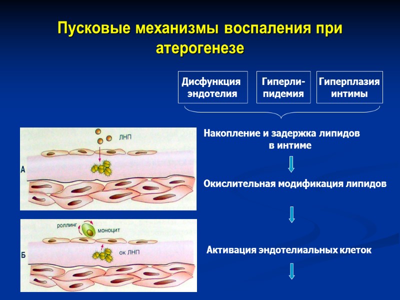 Пусковые механизмы воспаления при атерогенезе Дисфункция  эндотелия Гиперли- пидемия Гиперплазия интимы Накопление и